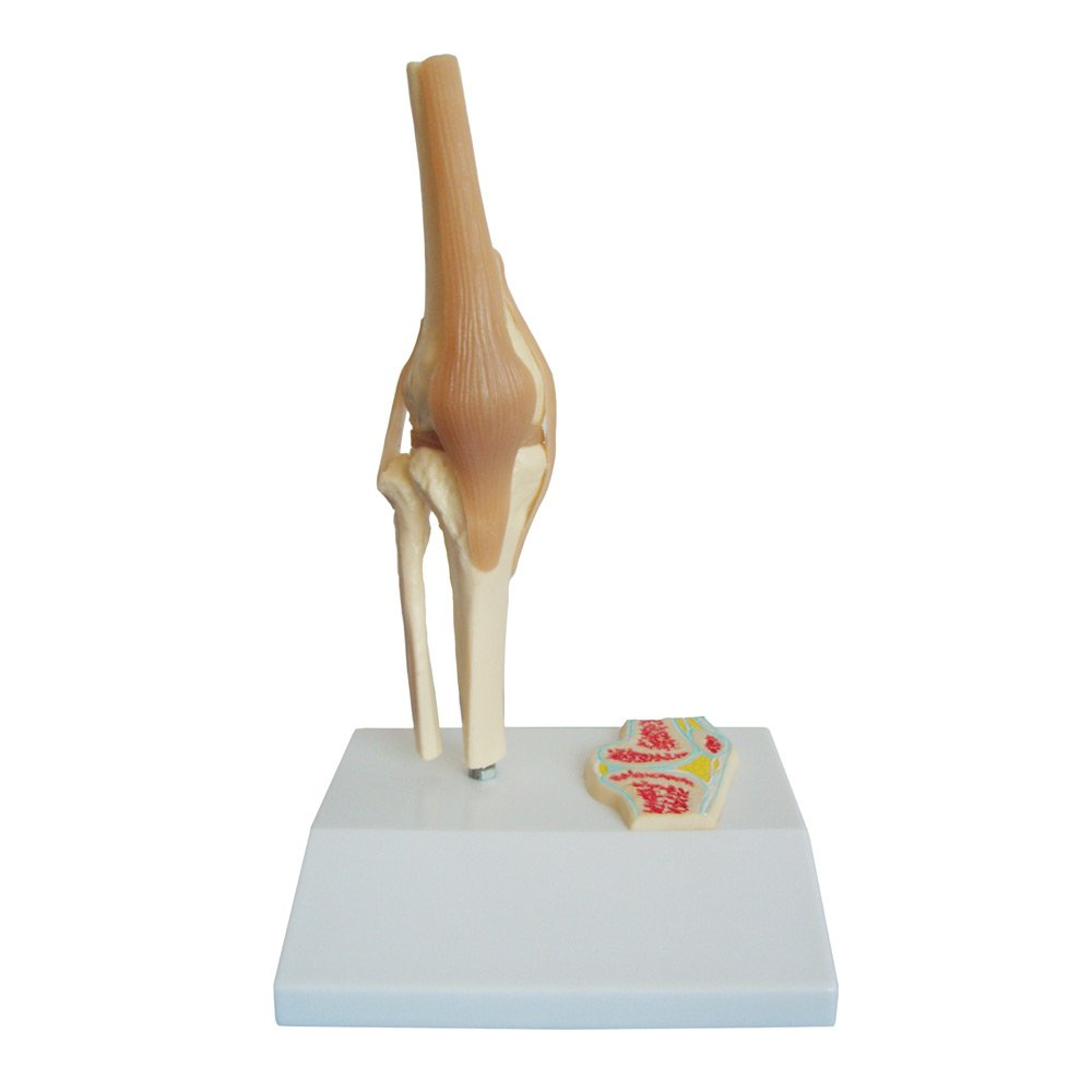 Kniemodell mit Sagittalschnittmodell